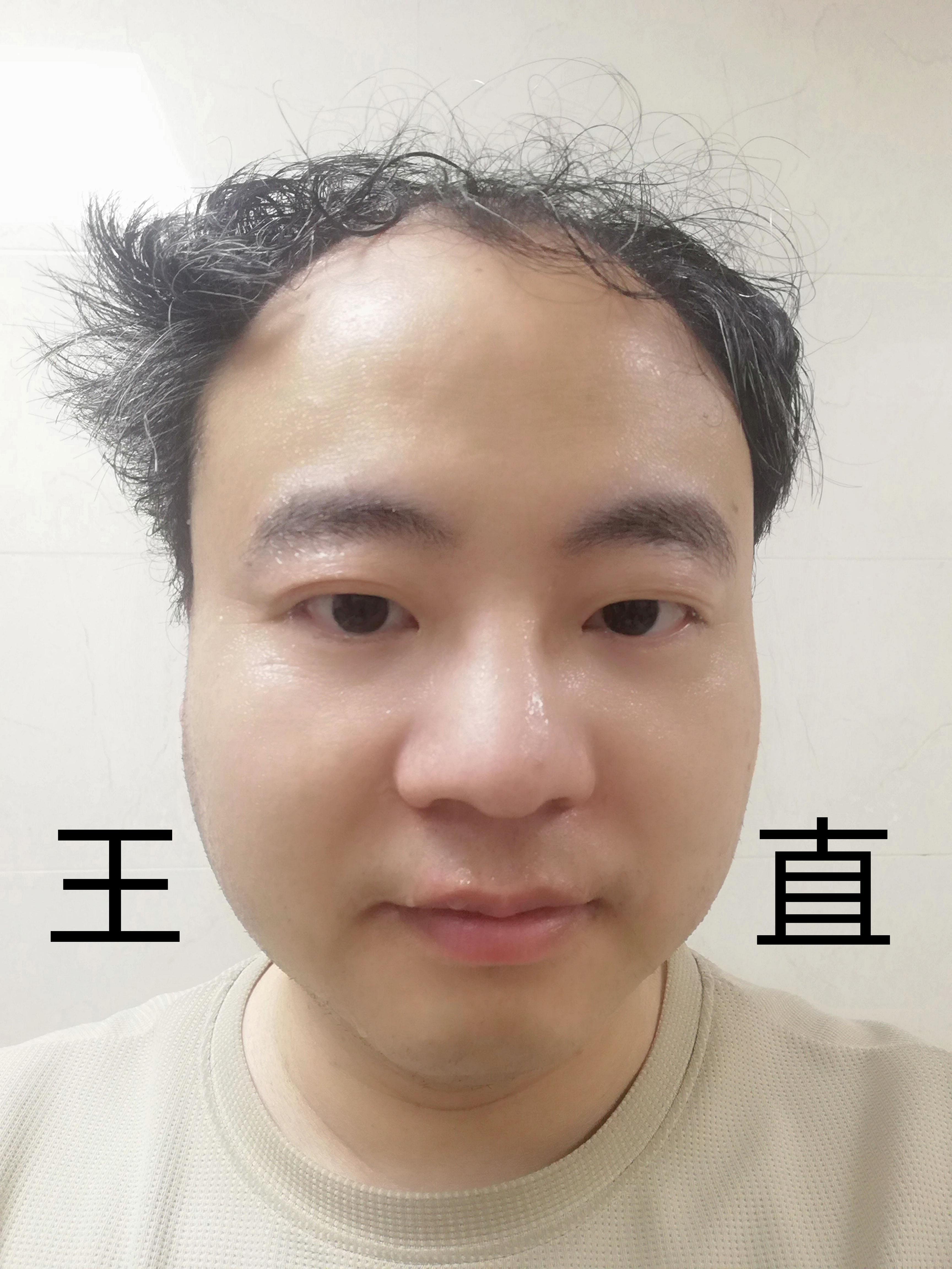 王直海贼王果实能力